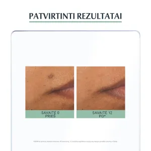 EUCERIN DermoPure odą atkuriantis serumas į aknę linkusiai odai 40ml